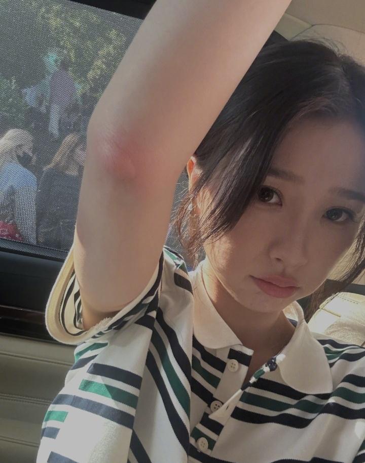 虞书欣超话虞书欣虞书欣萌物灿如繁星 
被蚊子咬了就这样用可怜巴巴的眼神看我们，虞