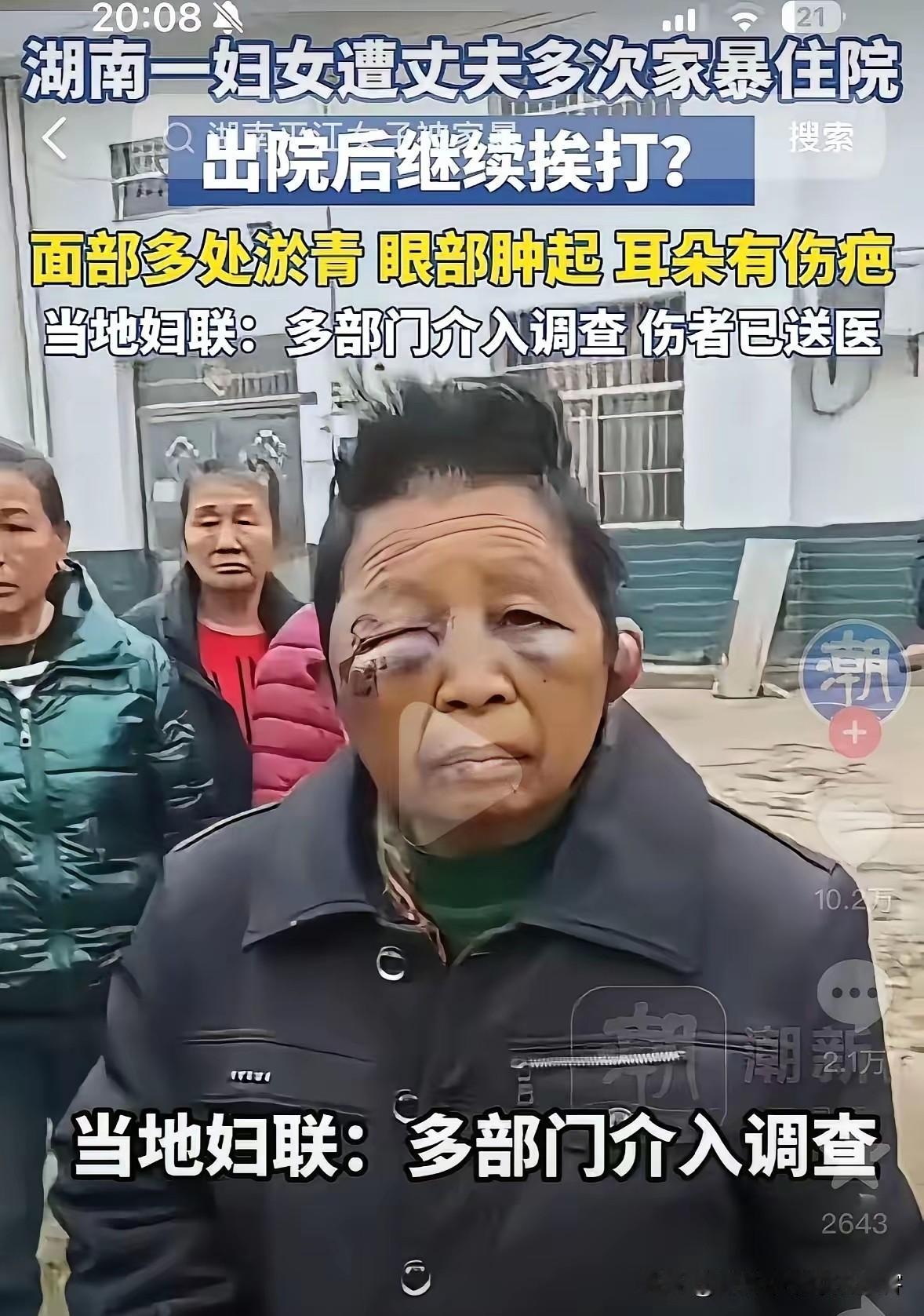 陈光明75岁了，酗酒打老婆，竟把老婆的耳朵打变形了。村里无人敢惹，村里口碑最差的