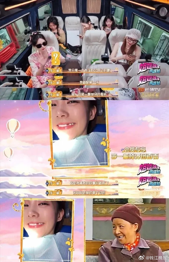 【#李一桐自曝缺牙照片#：因拍摄打戏被撞掉】#李一桐称拍打戏牙被撞掉# 李一桐也