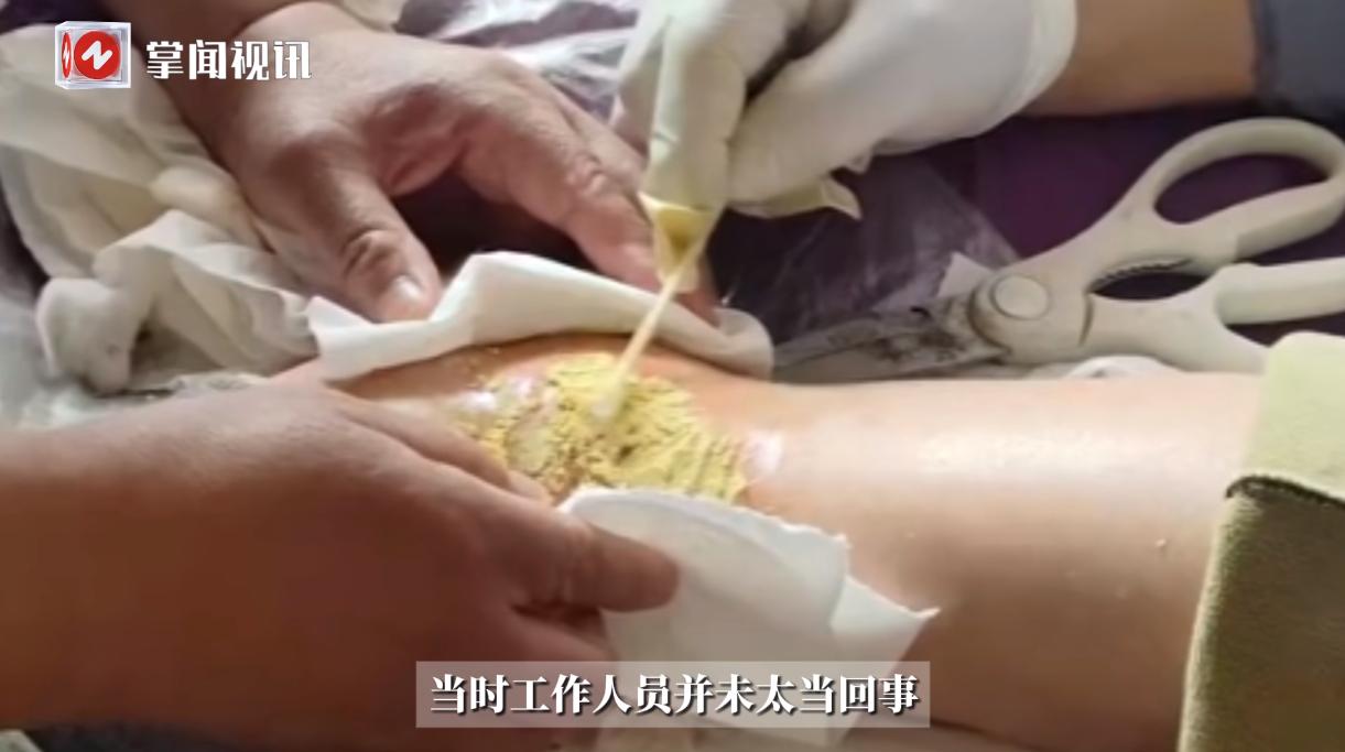 “冤不冤！”6月10日，辽宁大连，一女子听说有免费的艾灸可以体验，于是便跑到了艾