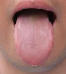 手心多汗心烦、面油便黏，根源多为阴虚兼夹湿热








前段时间有位男士咨