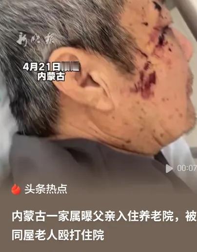 “必须严惩！”内蒙古赤峰，女子将丈夫送到养老院，几天后接丈夫，只见丈夫裤子直接裂