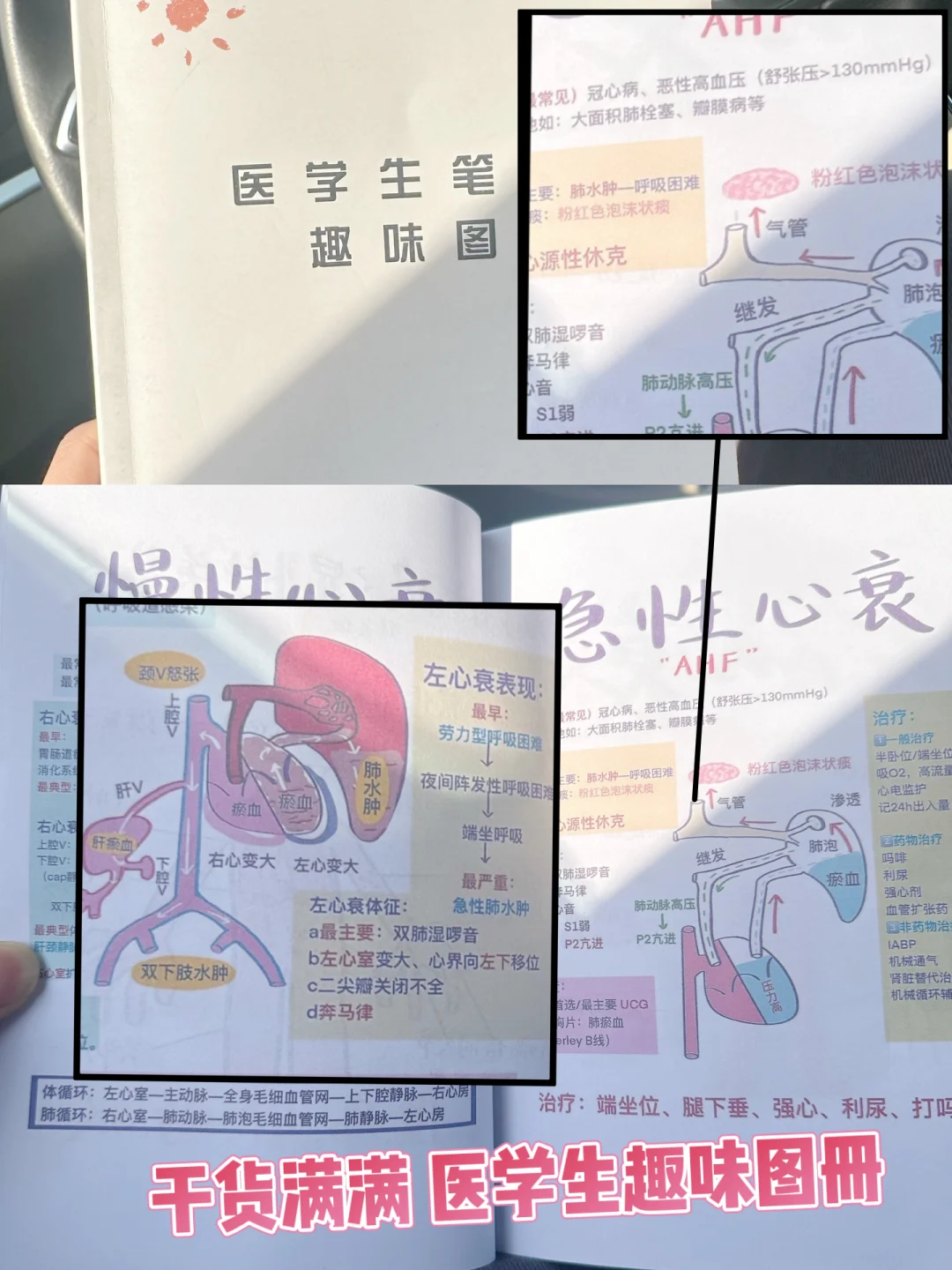 医学生趣味图实战