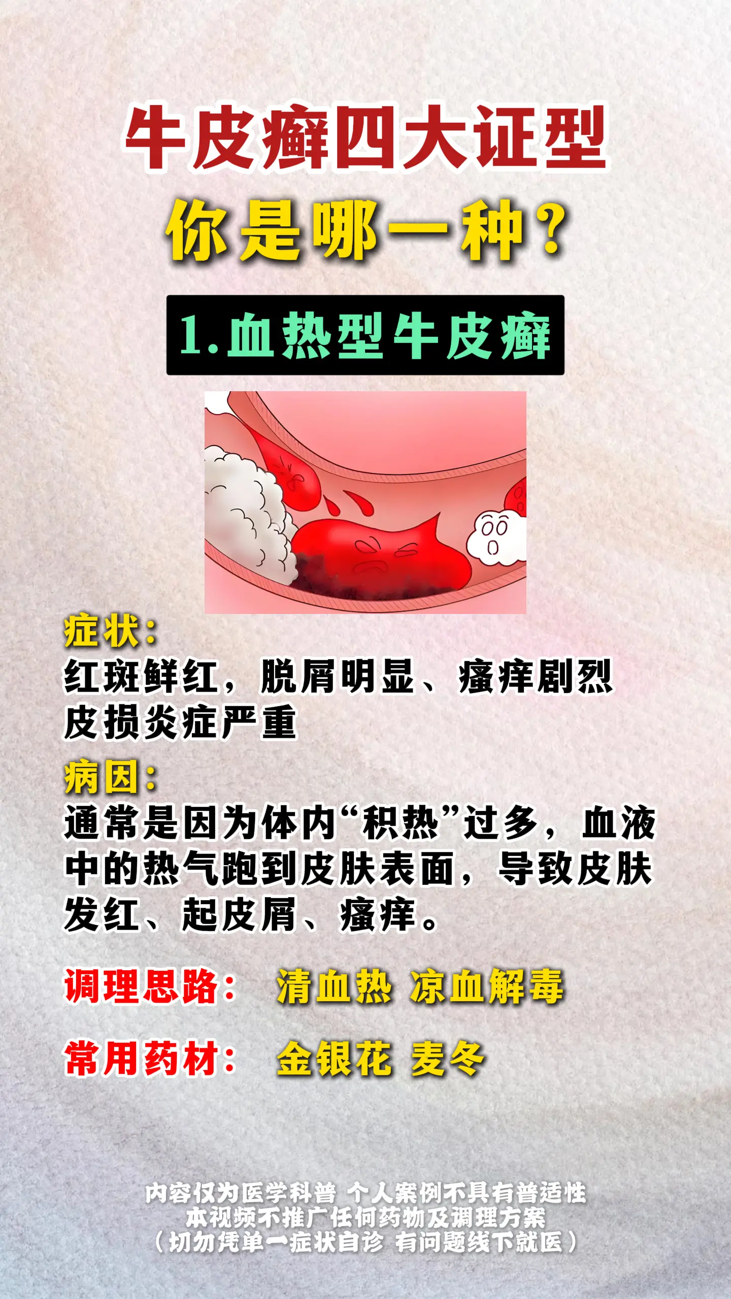 银屑病 牛皮癣 医学科普