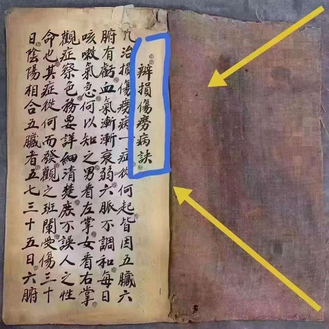 《辨損傷痨病訣》[福][福]清代跌打损伤道医书，书中有辨跌打损伤七十二症總訣等内