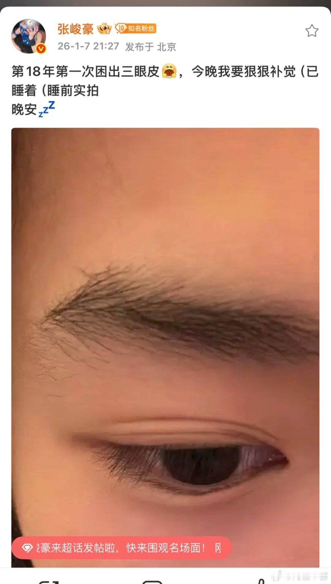 张峻豪双眼皮我只能说老顺好惨吧 不澄清被说了埋线 澄清了说sj粉圈 哈哈哈哈哈造