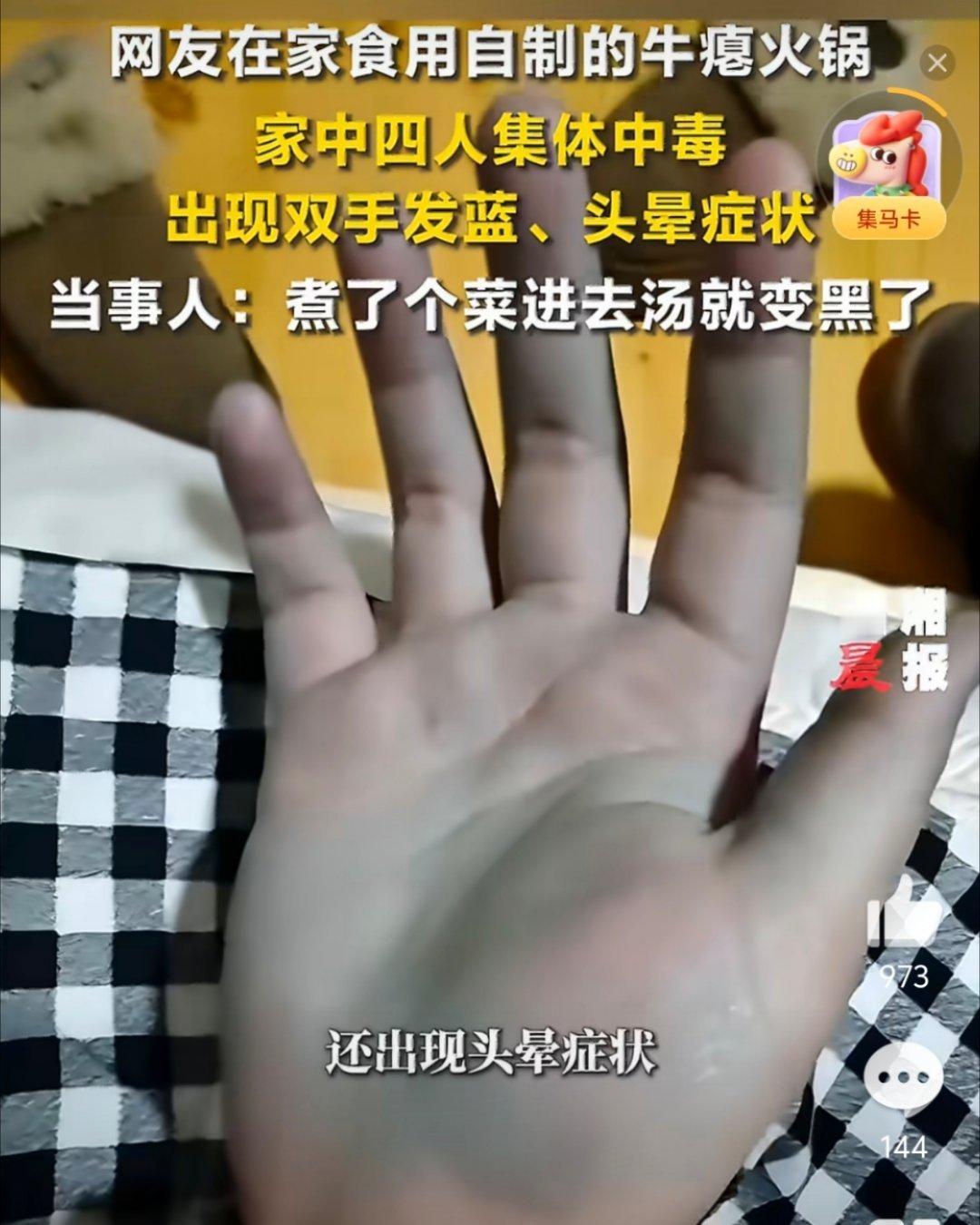 女子吃自制牛瘪火锅中毒双手变蓝 好家伙，汤都这颜色了还敢吃！ 