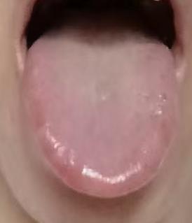 肝郁气滞合并气血亏虚，男性问题的中医辨证调理思路







粉丝留言：身体机