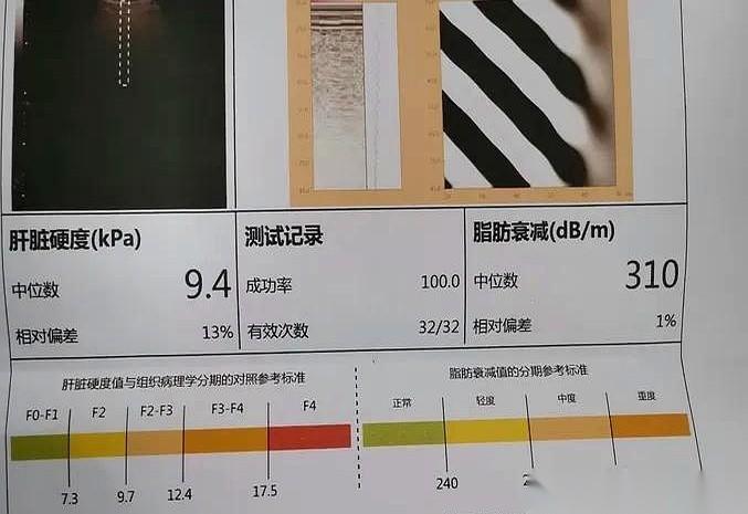 诊室里，一个男人把手放在膝盖上，指尖一下下敲着裤子。
他吃了两年抗病毒药，人看着