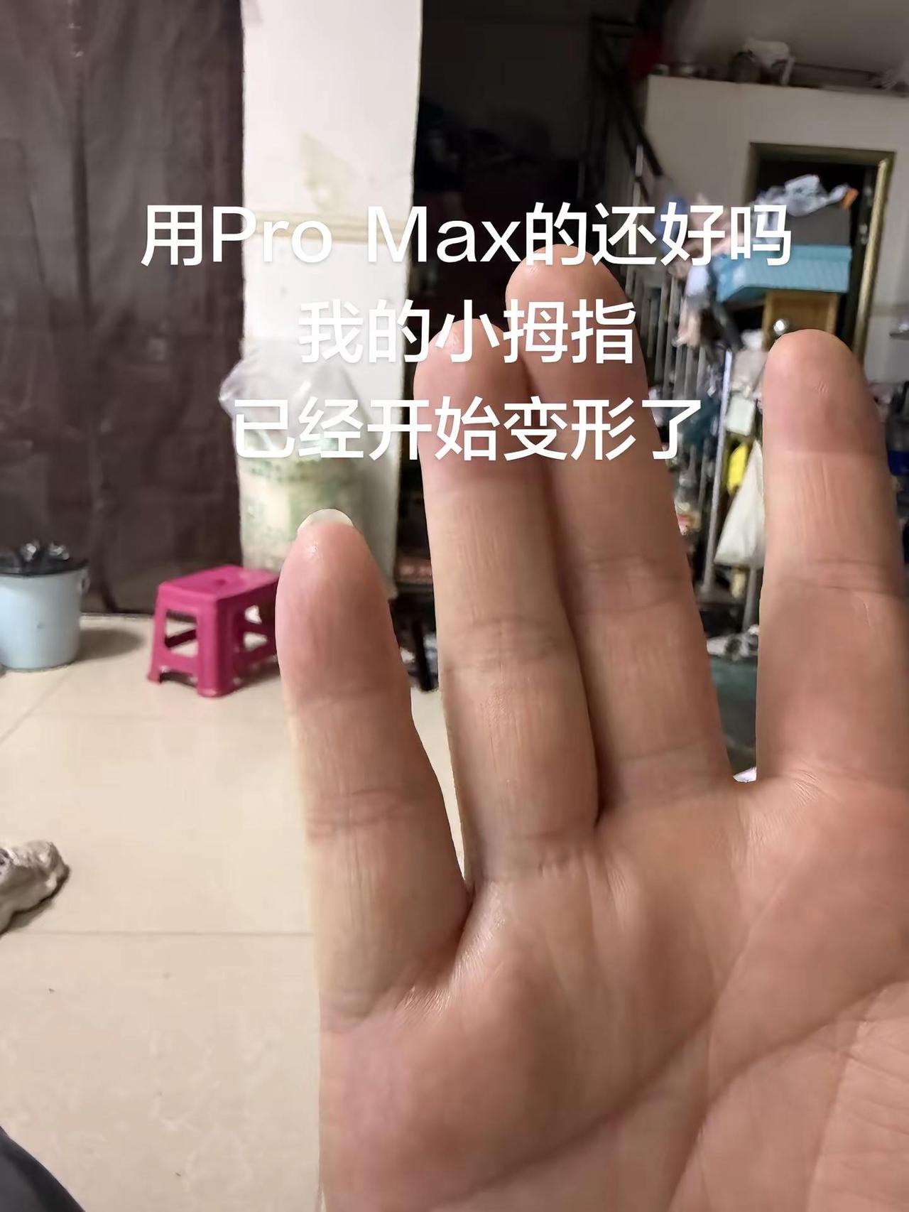 我的小拇指已经架不住我的手机了
