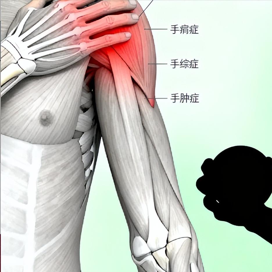 偏瘫后上肢麻木疼？光知道忍着就错了！

偏瘫后感觉手麻胳膊麻，千万别干忍着，这其