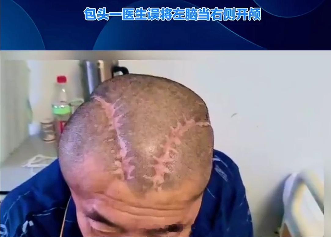 男子右脑出血被医生错开左脑 郭德纲相声里“腿折了，医院先拉开肚子再问什么病”的段