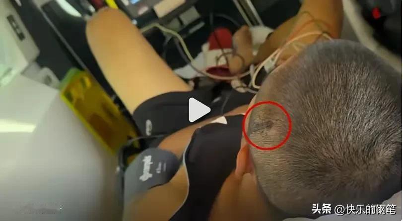 一段关于华人拳击手周润琪在澳大利亚遭遇暴力袭击的自述视频引发了中文互联网的广泛关