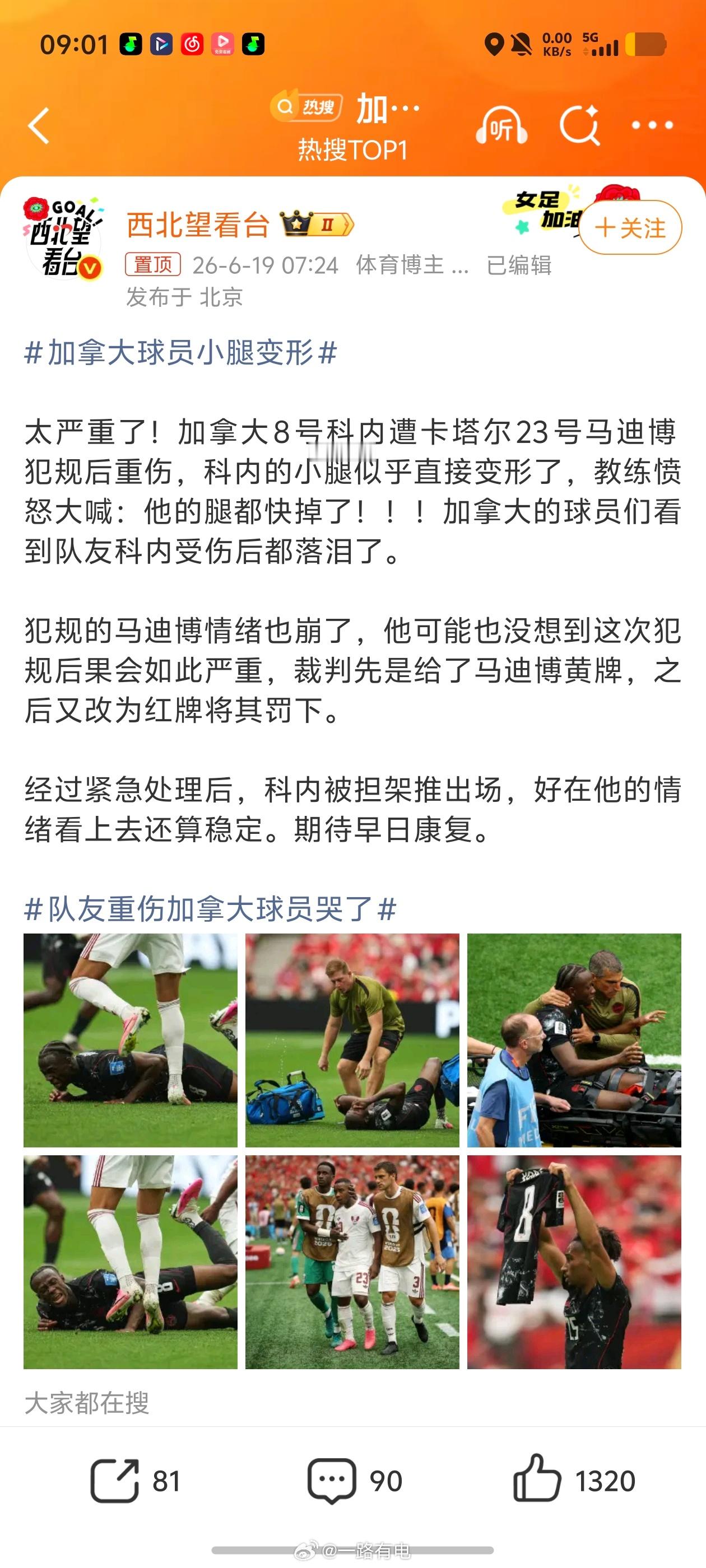 加拿大球员小腿变形竞技拼抢应有底线，这种极易造成生涯毁灭性伤病的危险铲球必须从严
