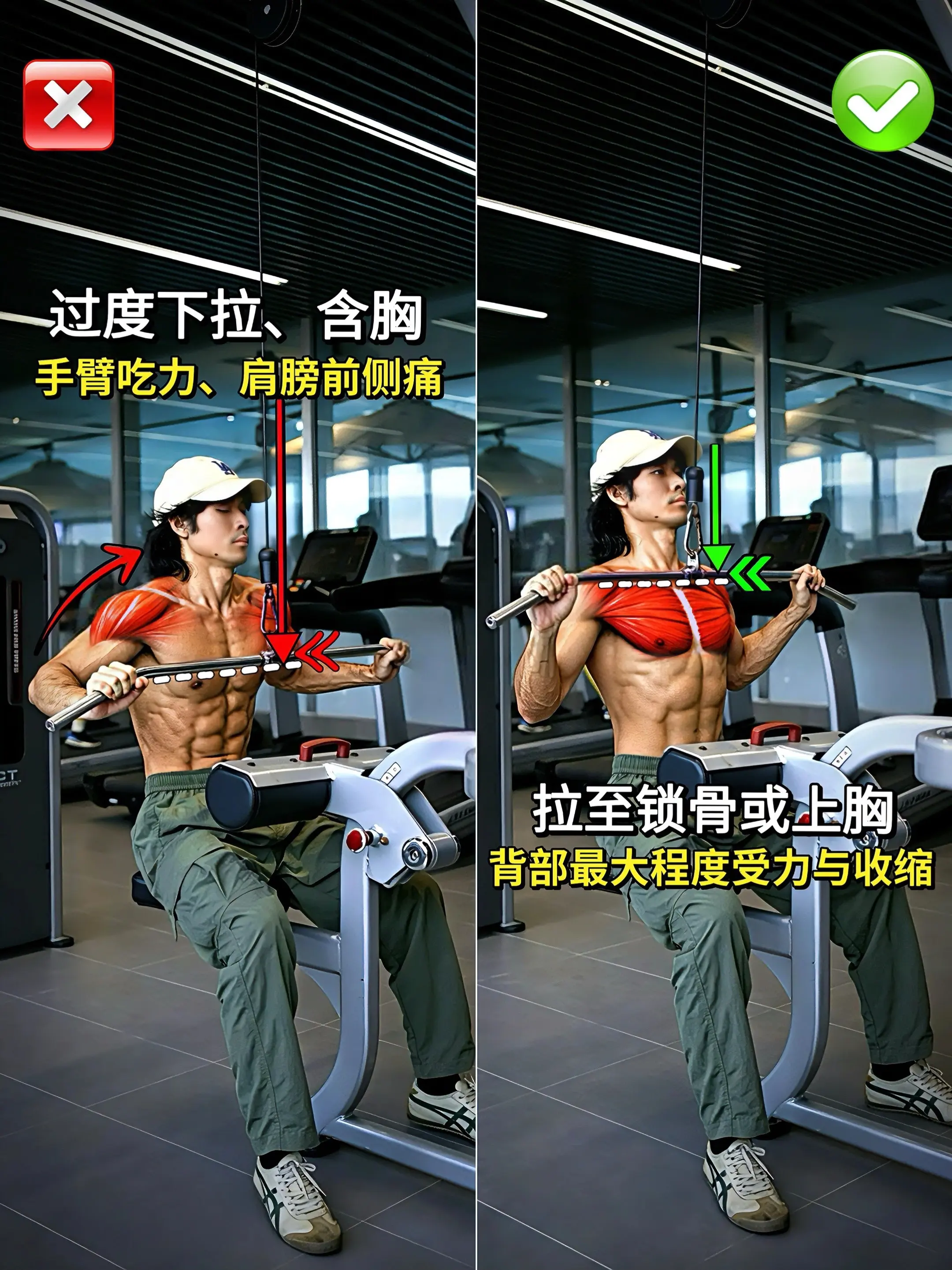 高位下拉详解！高位下拉常见错误及纠正。高位下拉全面拆解，所有的细节都在...