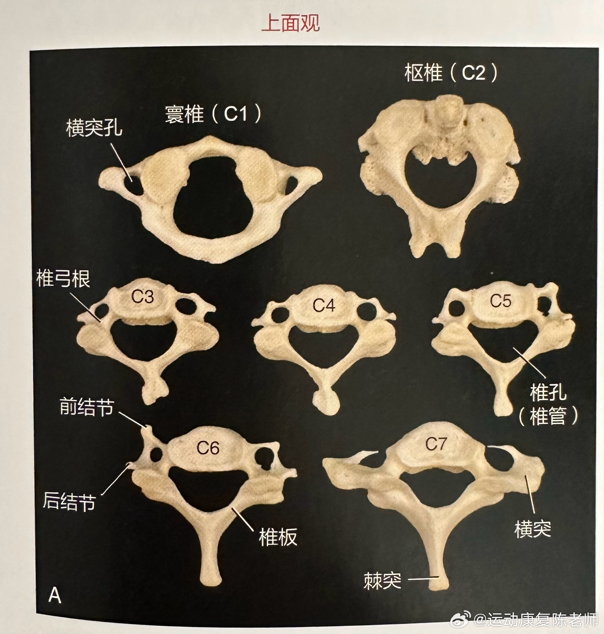 这条不讲损伤了[doge]来聊聊天，看个你的颈椎——你觉得哪一节最令你印象深刻[