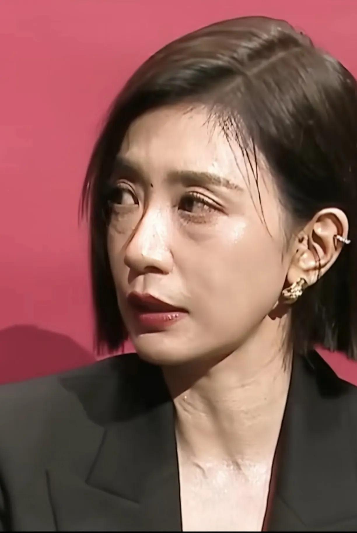 贾静雯眼袋黑眼圈也太明显了，如今医美这么发大，把眼袋去掉会更年轻。
