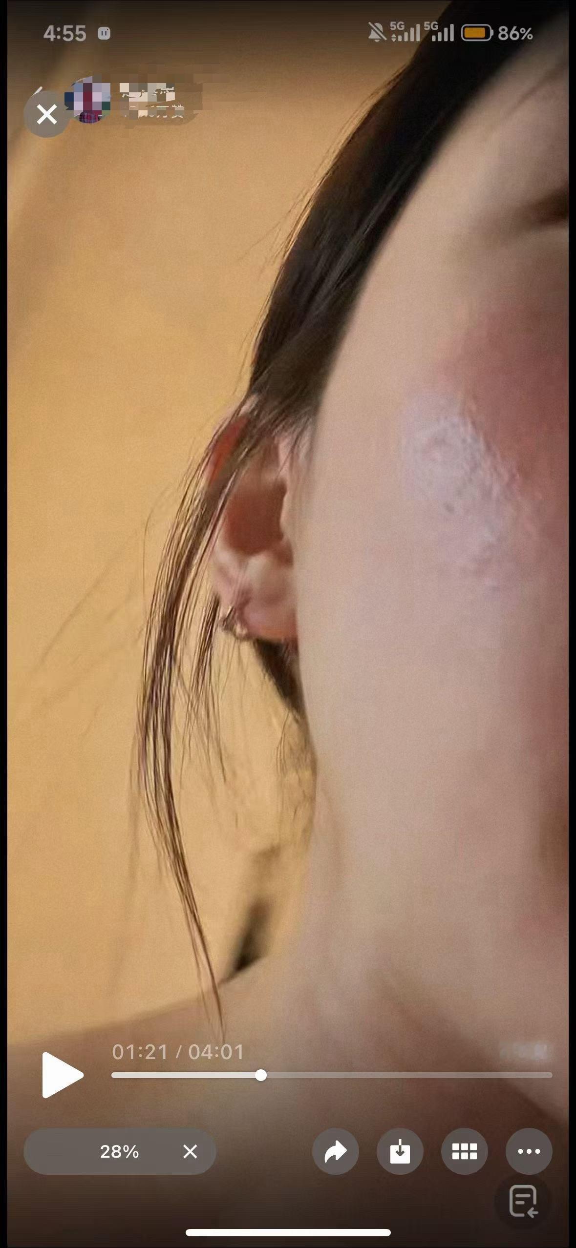 做坏事的人皮肤会长痘痘 长闭口 长黑头 长粉刺 长脓包～那是他应得的～ 