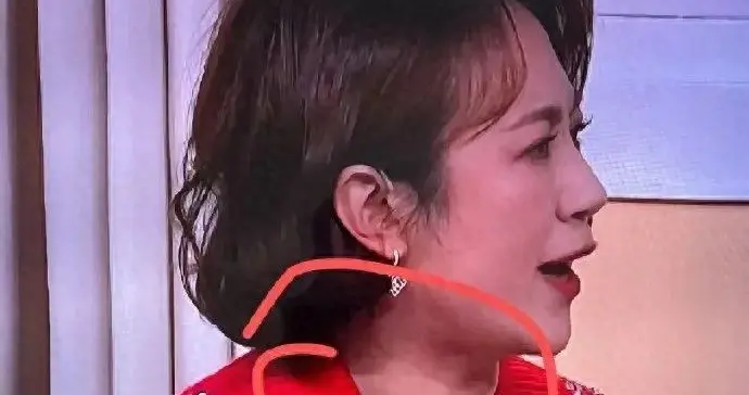 春晚小品中马丽的甲状腺引关注！网友劝其做检查，本人曾回复粉丝：查了有结节