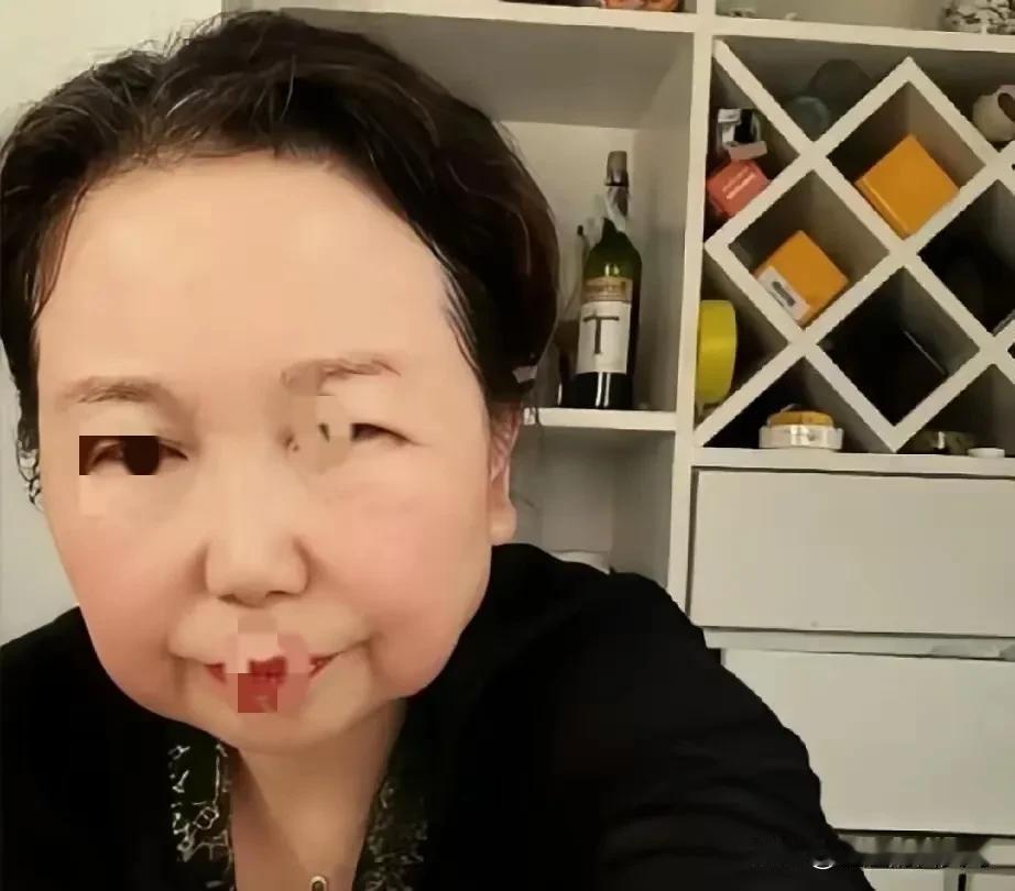大娘去整了容，把脸上那些沟沟壑壑都给填平了，皮肤紧致起来，每天打扮得花枝招展，跳