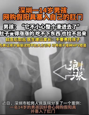 “无知害死人”！深圳一14岁男孩，突然肚子胀痛，吃不下也拉不出，紧急送医后才得知