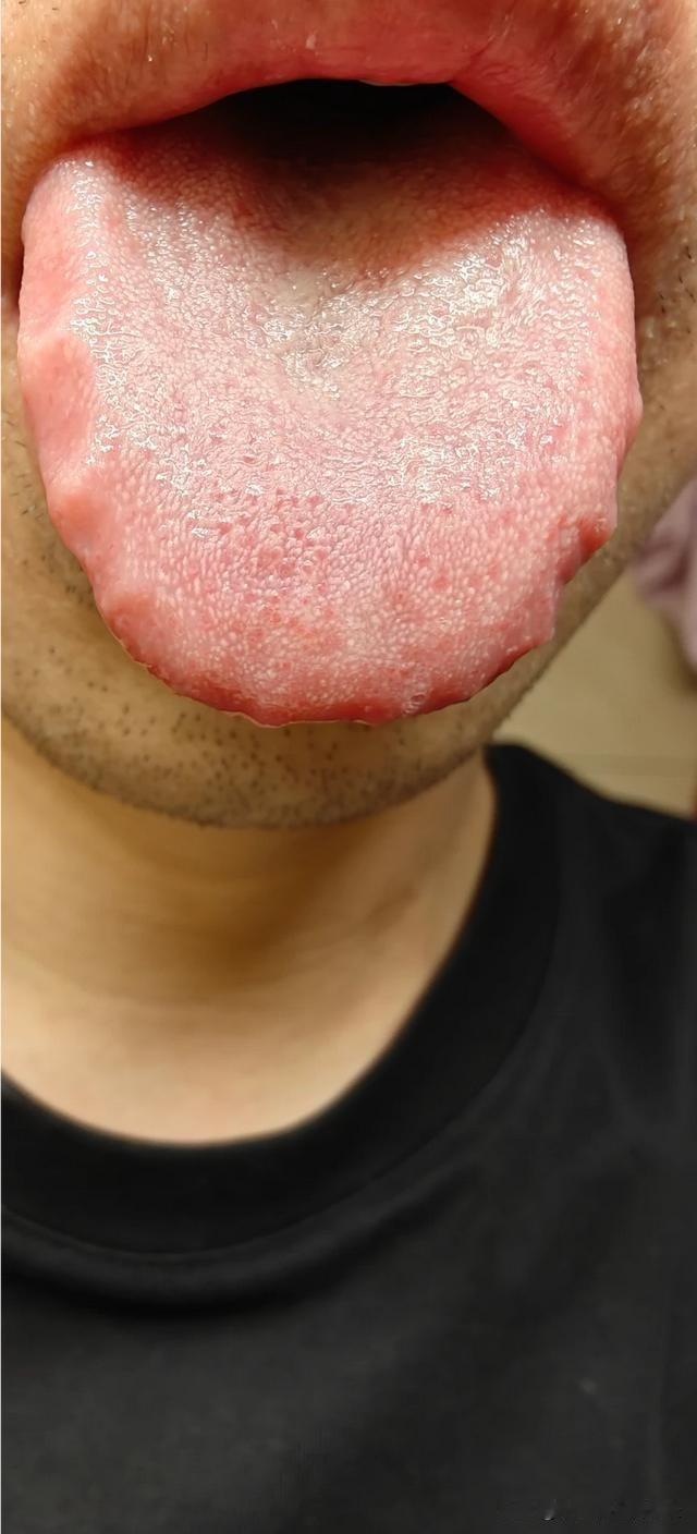 大哥你都四十多岁的人了，听点话吧！真不知道该说你什么好

健脾丸吃了，六味地黄丸