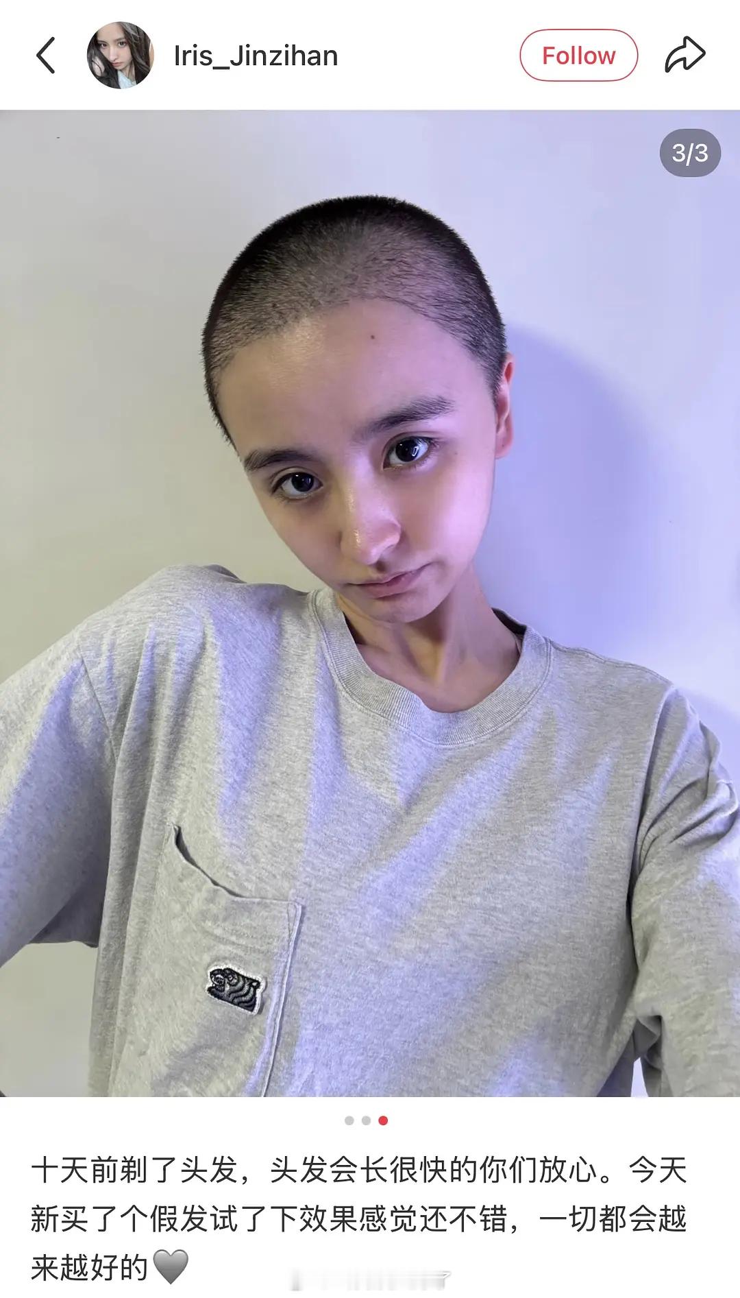 婧的金子涵剃寸头了，她这看起来才是真的状态不好…[拜托]金子涵剃寸头 ​​​