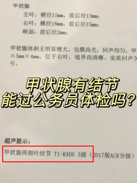 公务员体检有甲状腺结节，考公考编能上岸吗