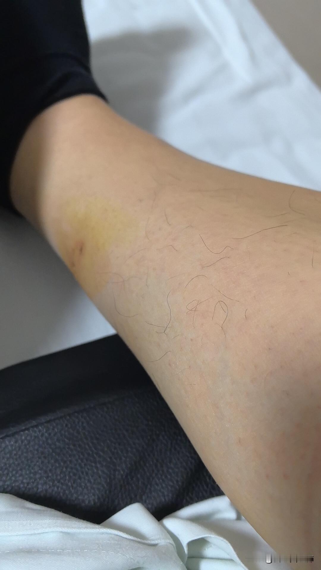 厄运专挑苦命人，我该怎么办
昨天晚上刚开完会，其实我是可以早下班的，哪知下班的时