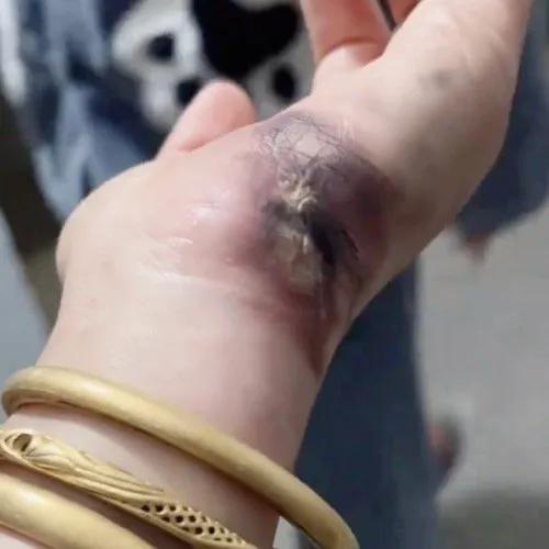 没想到手上的金镯子导电性能这么好！安徽宿州一位刘女士，在弄电动车充电口那个小盖子