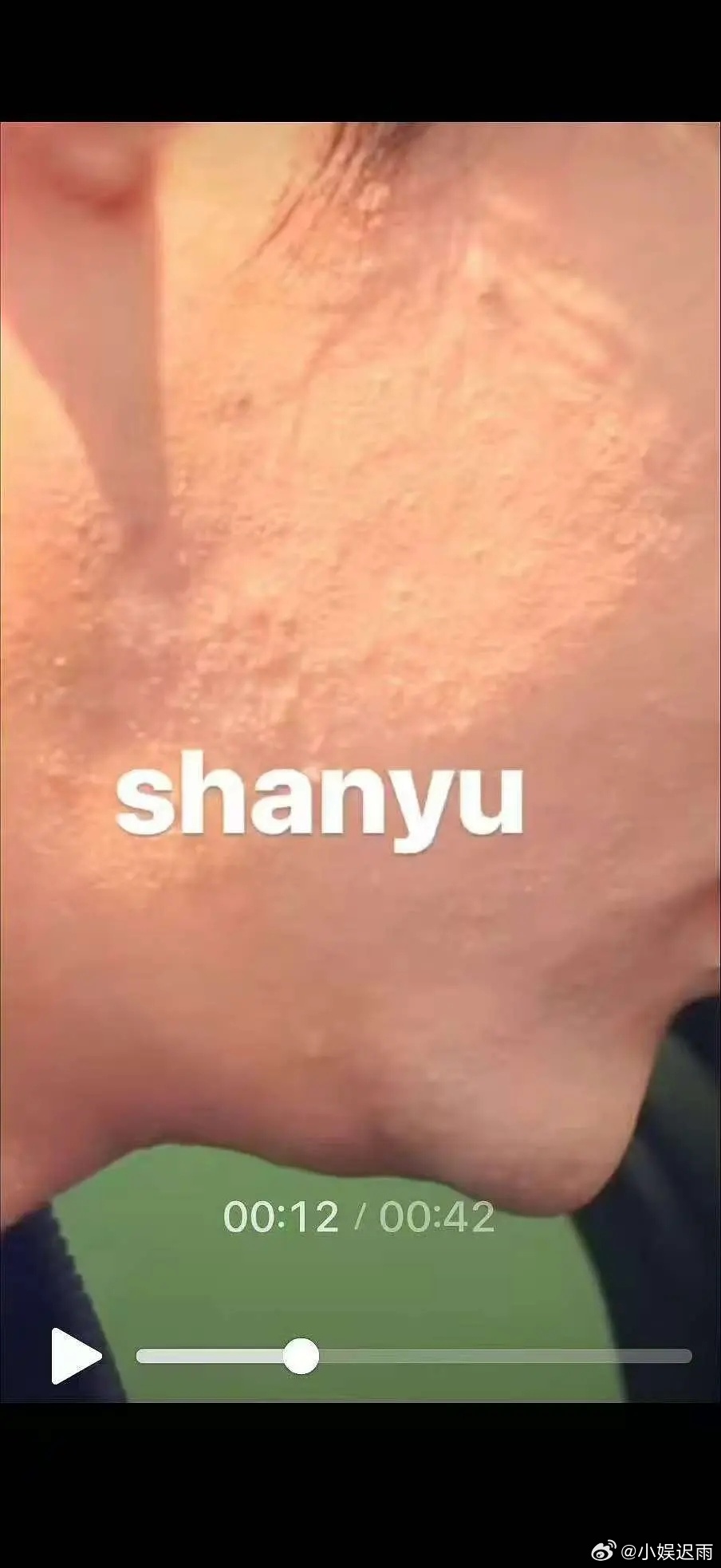 田栩宁的皮肤为什么是这样的！ 