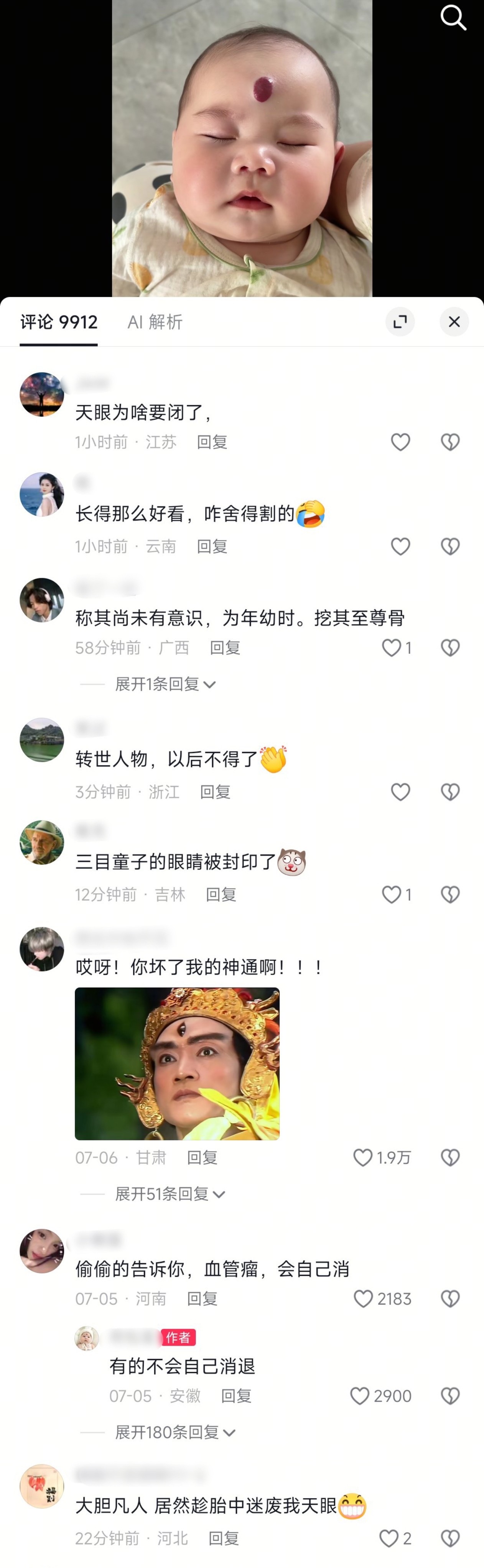 视频是一位妈妈带孩子做手术切掉了这颗痣（血管瘤），结果评论区很多人有意见。。。?