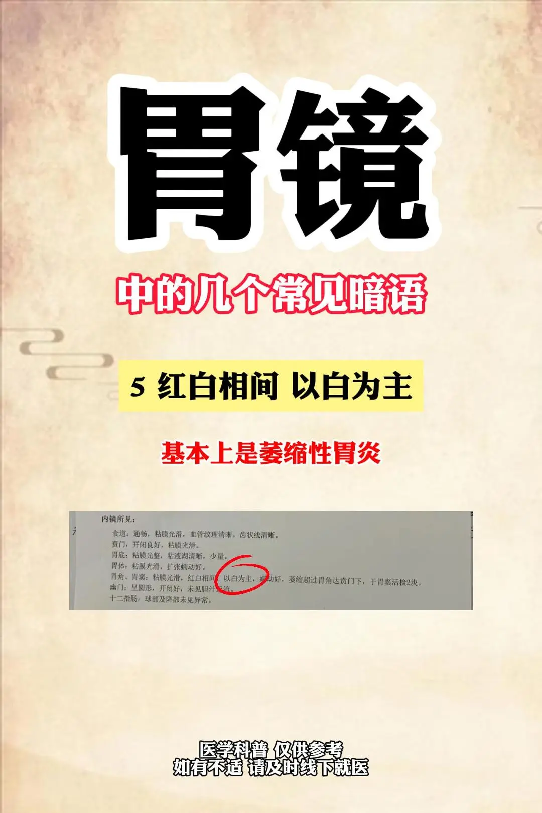 1分钟，教你看懂胃镜报告！。很多人拿到胃镜报告单之后，对其中的专业术语...