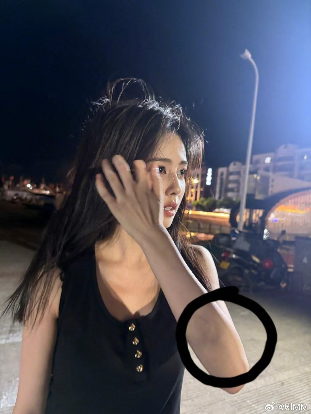 白鹿手臂淤青白鹿手臂上一片淤青，呜呜呜肯定很痛，鹿鹿一定要健健康康的啊白鹿手臂一