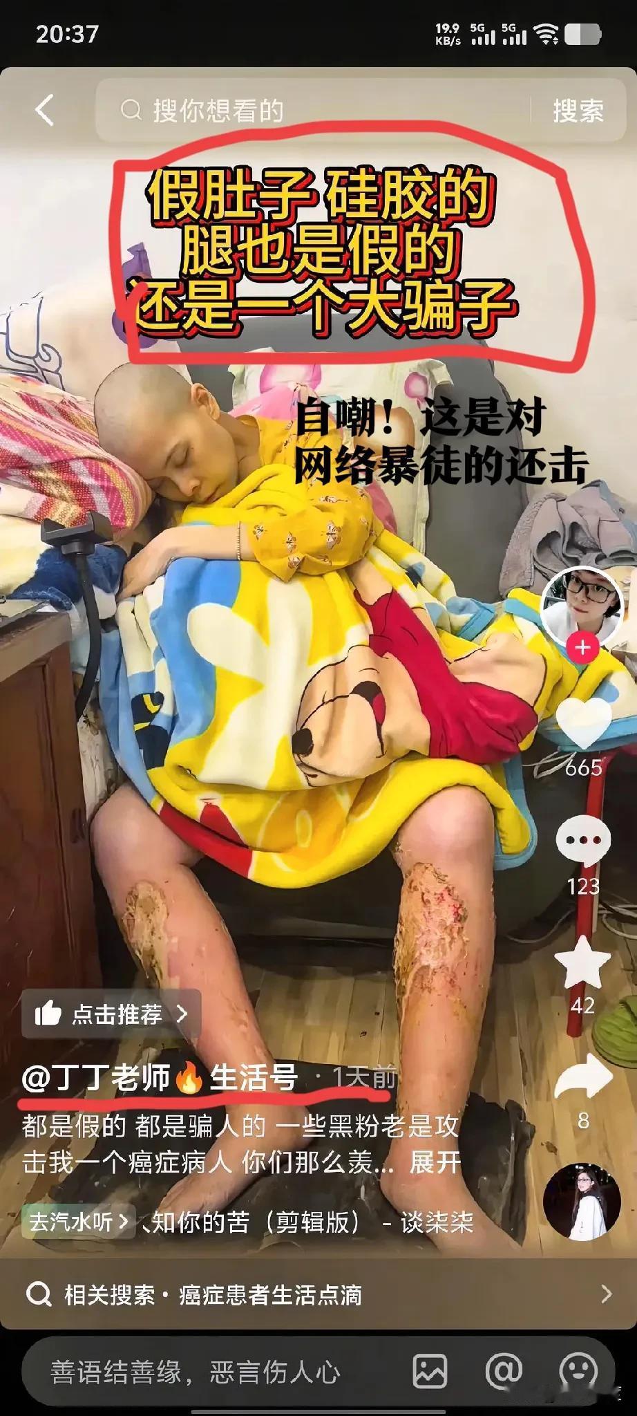 少点戾气，多些宽容吧！

笔者这两天刷到了一位名叫玲宝的女性抗癌失败的消息，现如