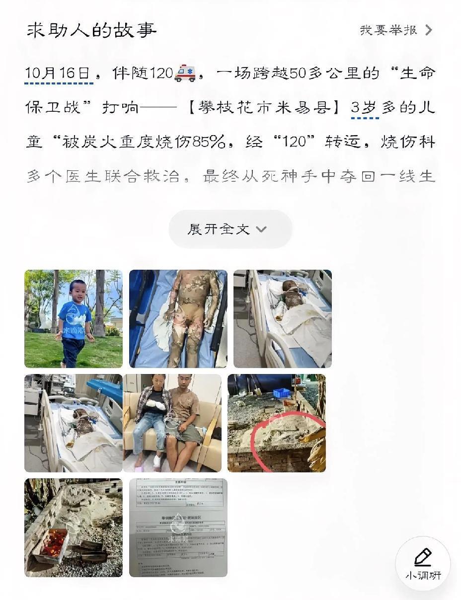 揪心求助！3岁男童误坠“隐形炭火堆”重度烧伤，母亲徒手救人致双手灼伤

3岁男童
