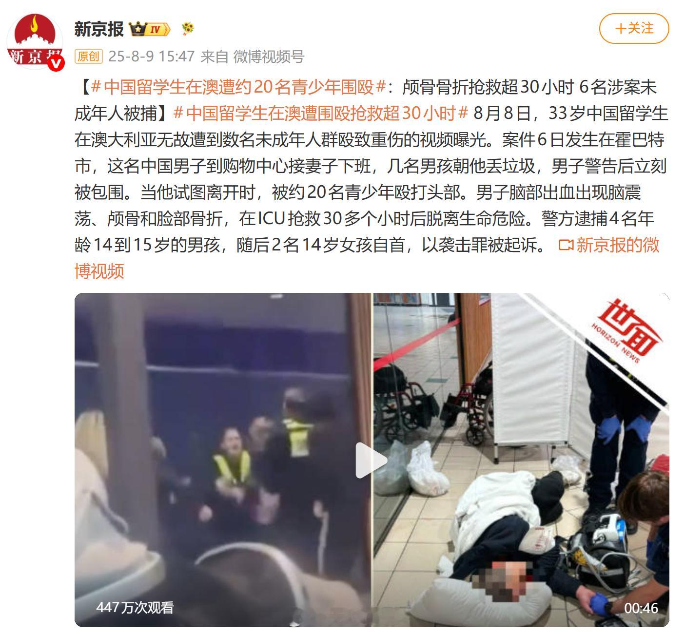 3中国留学生在澳遭2女子辱骂殴打 23岁中国女孩在澳被两女子打成重伤 中国留学生