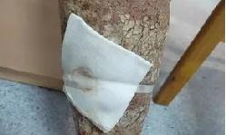 男子腿痒没在意 变成“树皮腿”
 
福州78岁的陈大爷怎么也没想到，不过是小腿偶