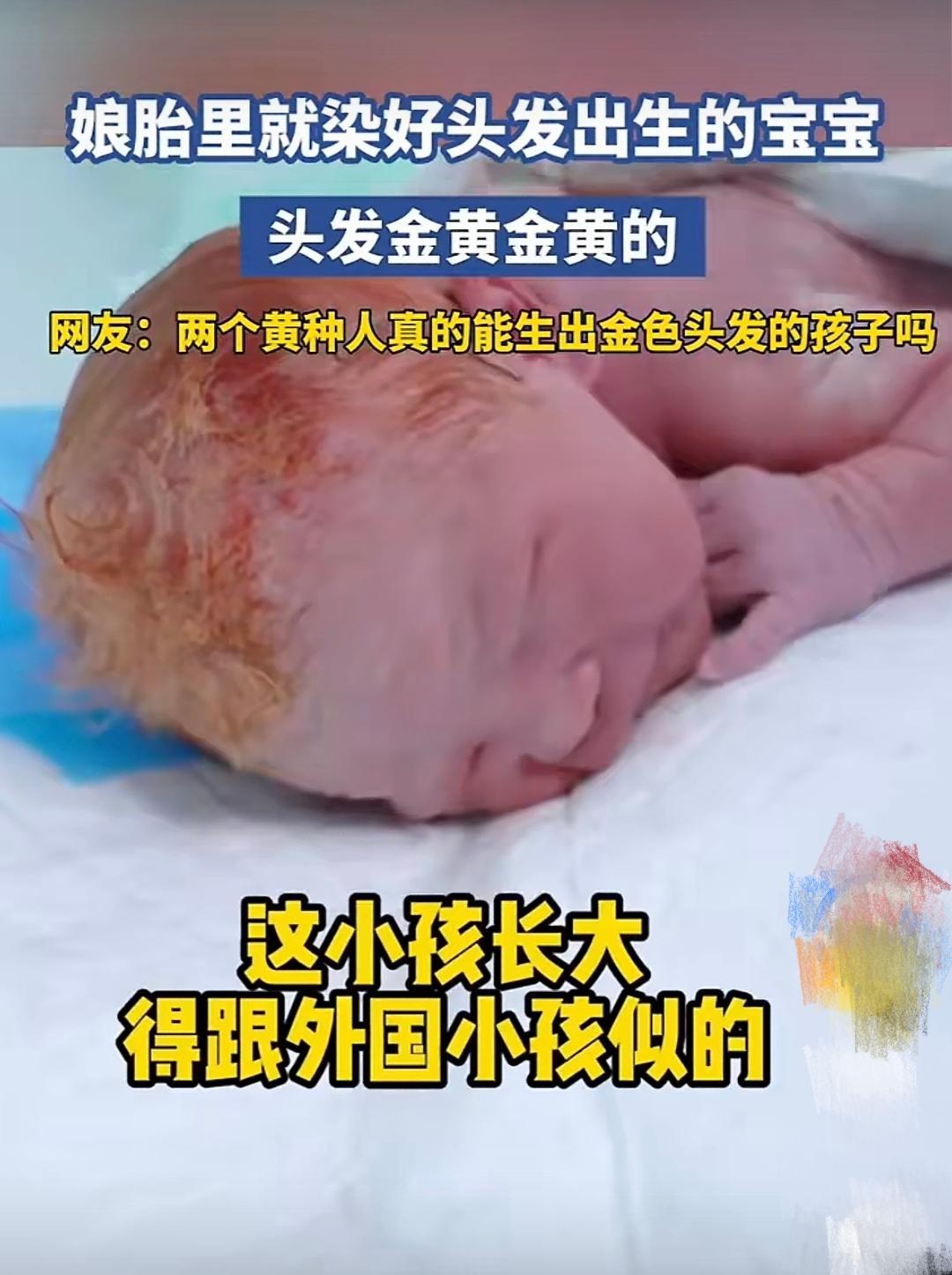 父母都是中国人，却生出个头发金黄的孩子，这合理吗？

宝宝头发金黄金黄的。孩子的