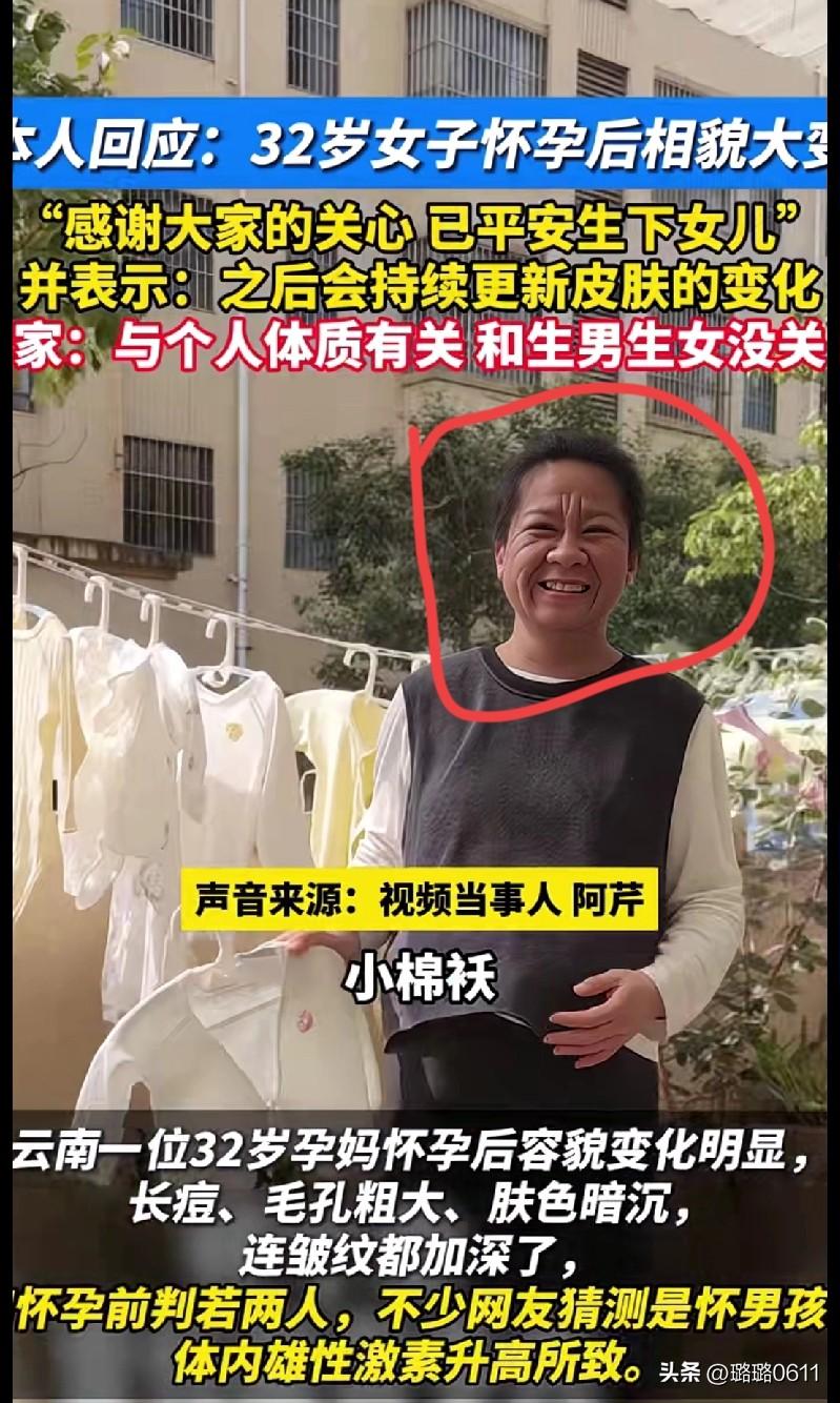 32岁孕妈怀孕后容貌大变，生完女儿报平安：和生男生女真没关系！
 
云南32岁的