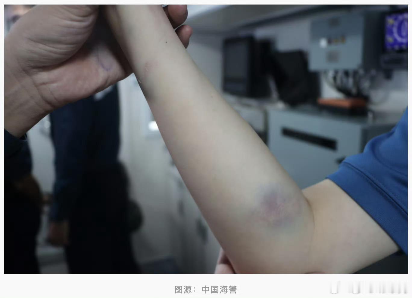 菲方人员恶意攻击罪证公布【罪证公布！菲方人员恶意攻击致使中方人员受伤】7月20日