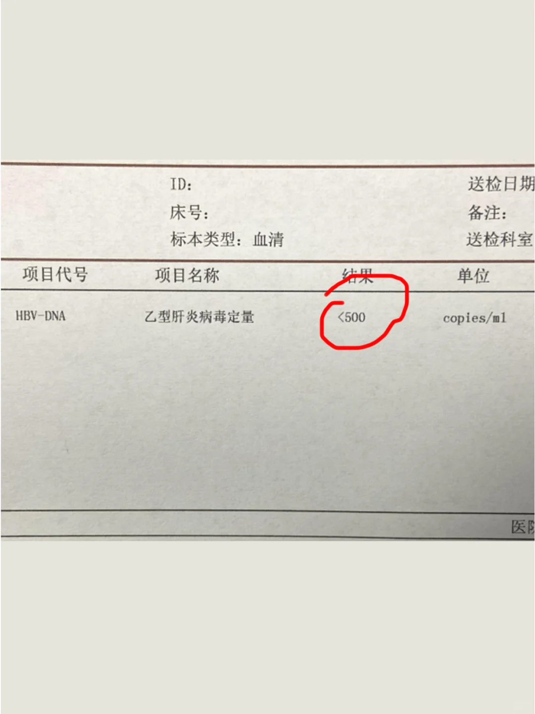 病毒量<500，为何还发展到肝硬化？