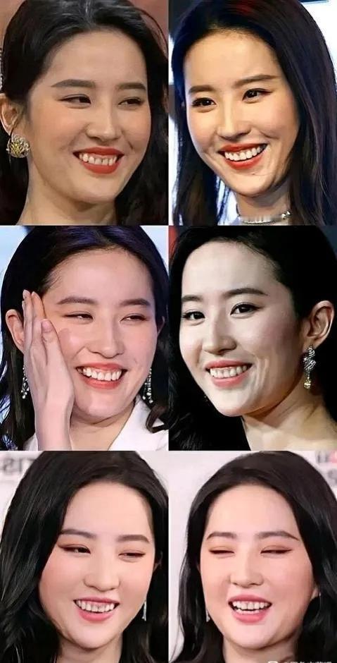 美如天仙的神仙姐姐也有缺点，冷艳的时候非常的美，笑起来的时候不太好看。