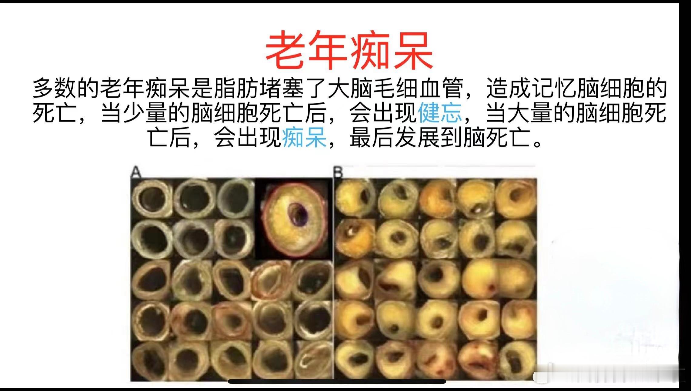 心力、胃力、脑力，这三力在0-7岁阶段发育完60%，在8-12岁再发育个30%，
