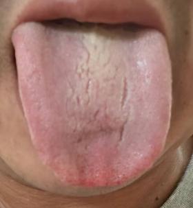 体虚寒热错杂，夜里盗汗、入睡困难，脾虚阴虚该如何辨证调养？







有粉丝