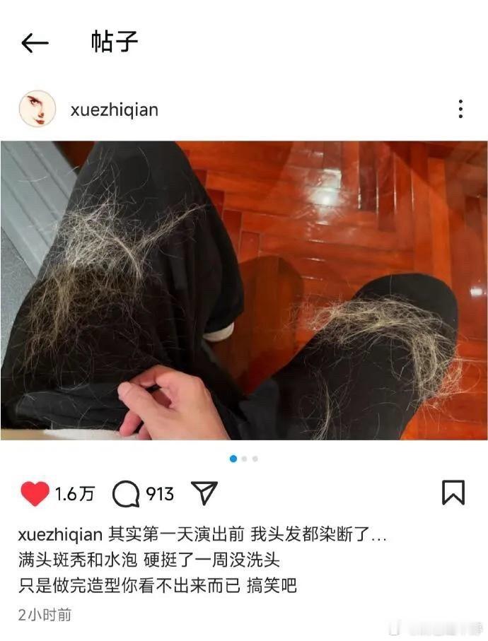 薛之谦满头斑秃和水泡看到薛之谦为了巡演造型漂染导致满头斑秃、水泡，真的挺让人唏嘘