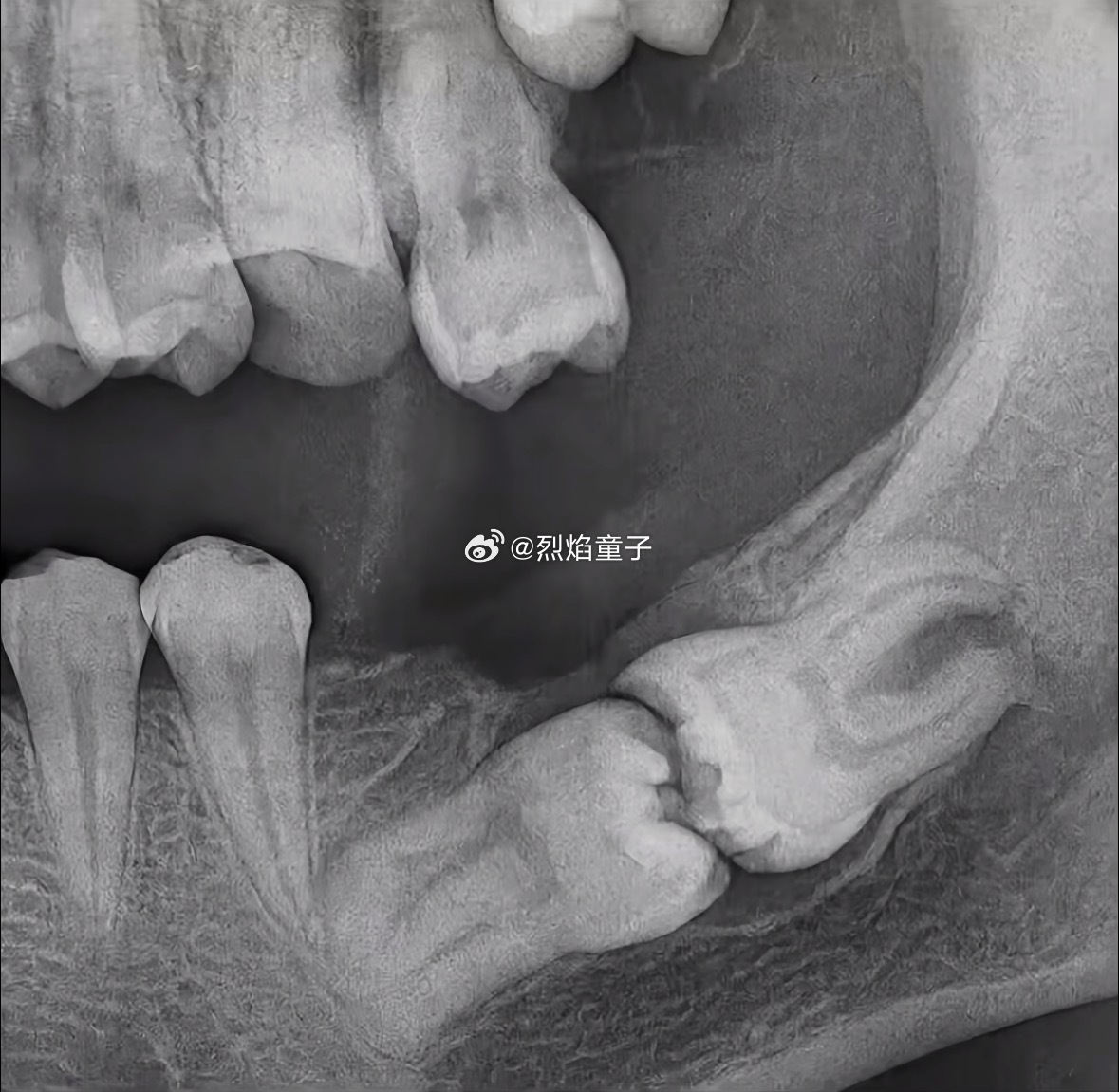 下面这两个算得上是祖传榫卯结构了上面那颗牙好八卦呀，伸长了脖子下来看