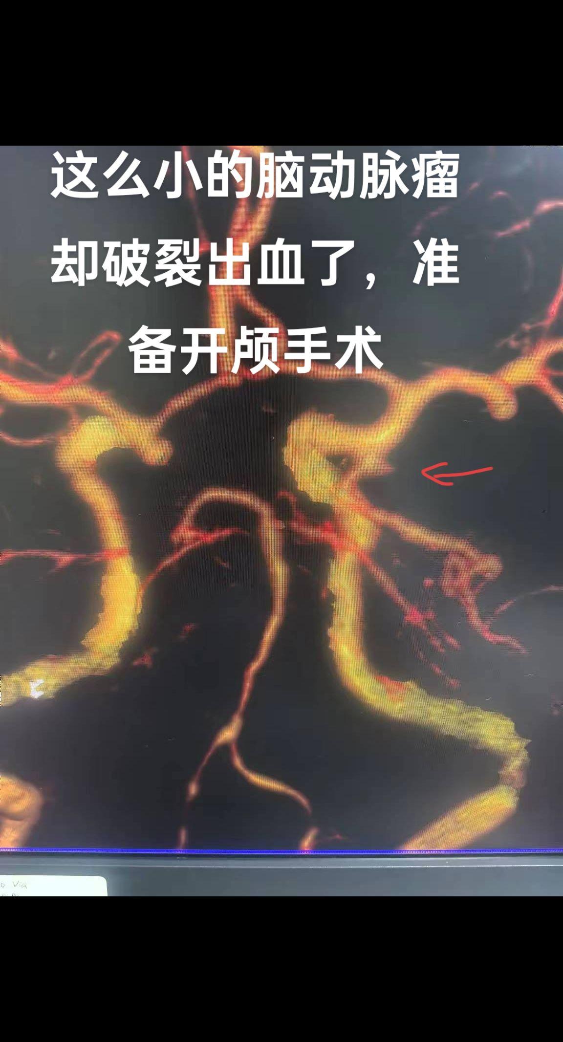 医生日常 抖医医生
