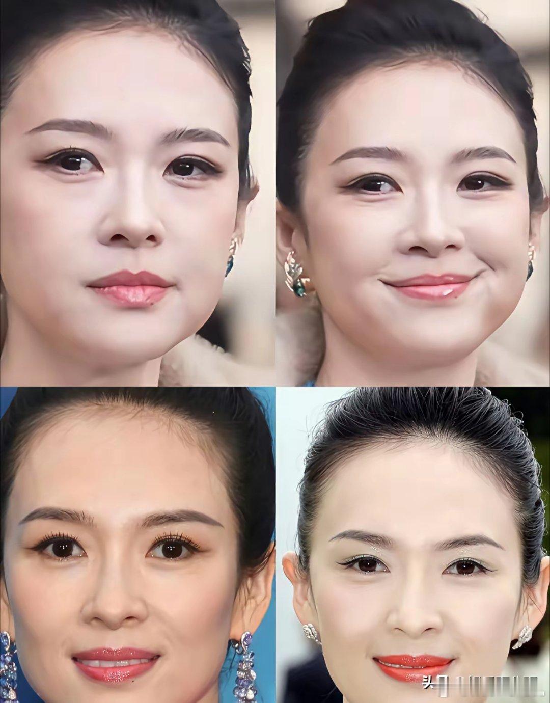 章子怡这张脸看着越来越美了！卧蚕应该也是新做的，整个五官大了一轮，大家能看出来具