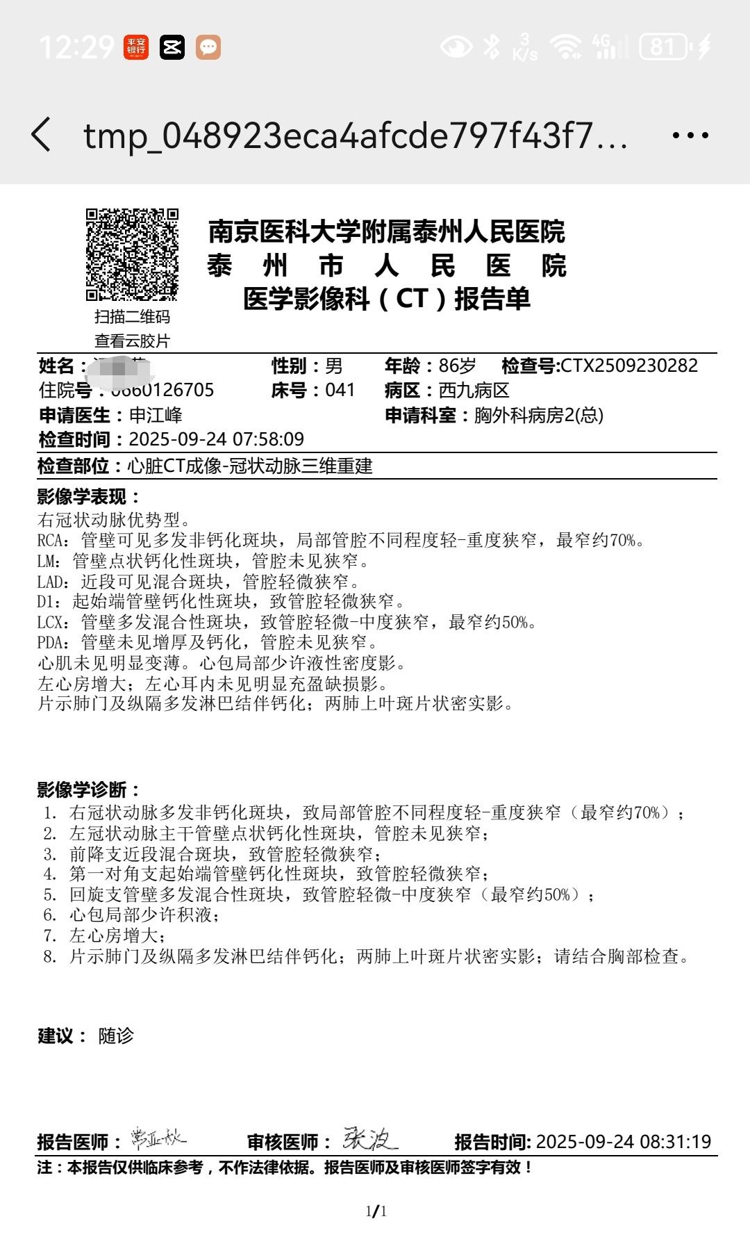 确诊了！冠心病！管壁可见多发非钙化斑块，局部管腔不同程度轻-重度狭窄，最窄约70